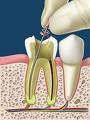 Endodoncia